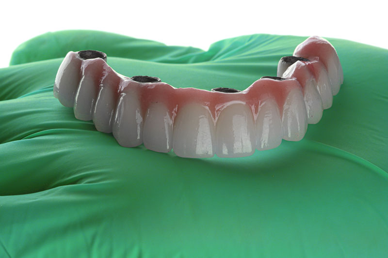 a full arch of teeth with 4 holes for implants to be placed