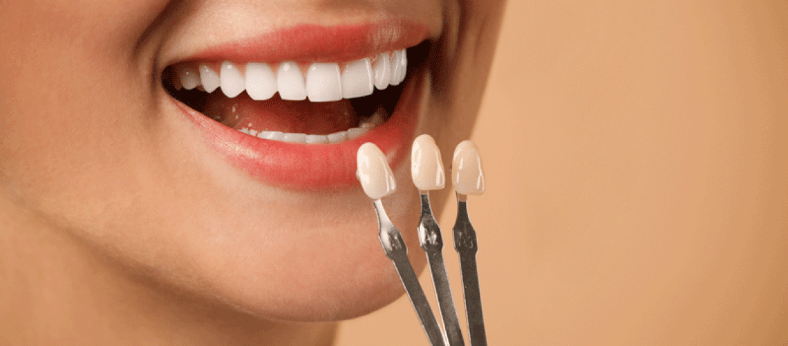 Doctor checking young woman's teeth color on beige background, closeup. Dental veneers