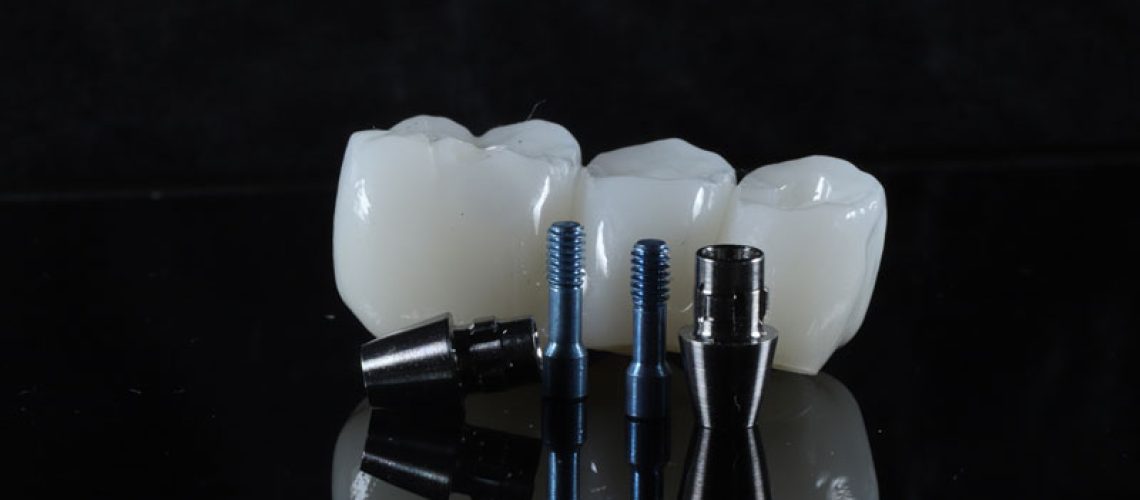 a dental bridge being shown with dental implants next to it